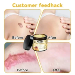 Winter Sale AEXZR™ Bee Venom Skin Treatment Cream