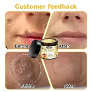 Winter Sale AEXZR™ Bee Venom Skin Treatment Cream