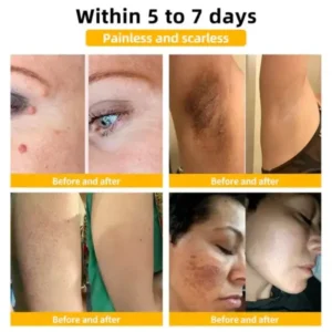 Winter Sale AEXZR™ Bee Venom Skin Treatment Cream