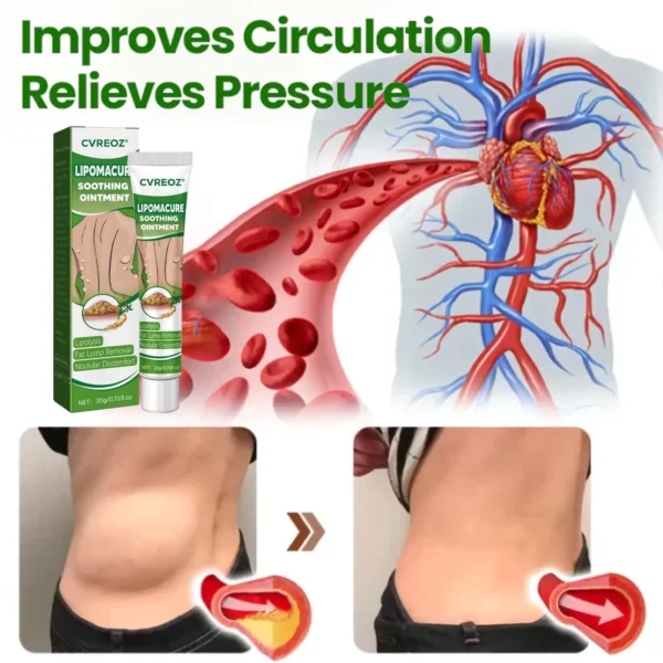 ⏰Last Day Promotion: 60% OFF🔥 Cvreoz® LipomaCure Soothing Ointment