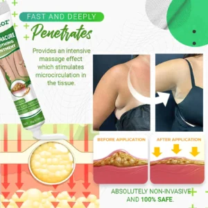 ⏰Last Day Promotion: 60% OFF🔥 Cvreoz® LipomaCure Soothing Ointment