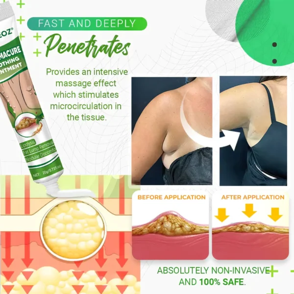 ⏰Last Day Promotion: 60% OFF🔥 Cvreoz® LipomaCure Soothing Ointment