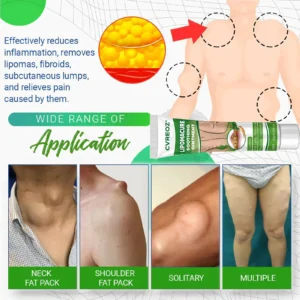 ⏰Last Day Promotion: 60% OFF🔥 Cvreoz® LipomaCure Soothing Ointment