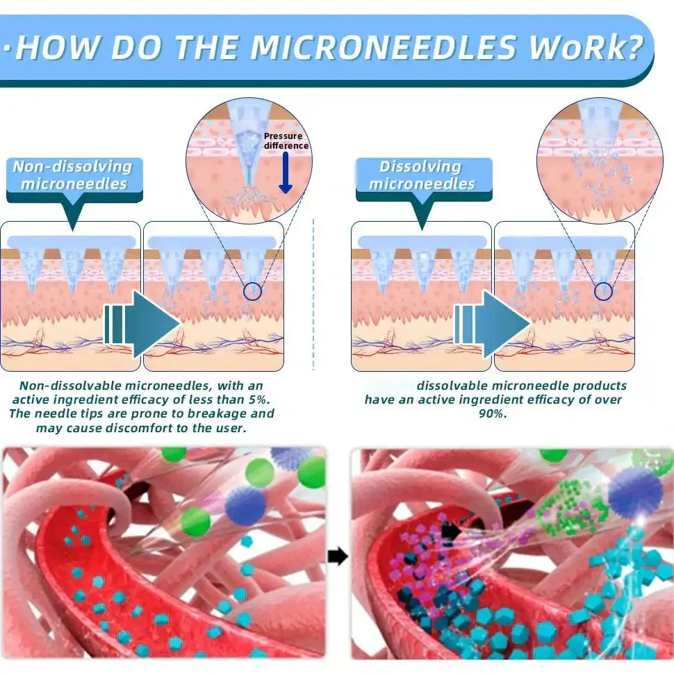 【NATRAVOR® Official Store👨🏻⚕️】 𝐍𝐈𝐃𝐃𝐊-𝐓𝐢𝐫𝐳𝐞𝐩𝐚ti𝐝𝐞 𝐍a𝐧𝐨 𝐌𝐢𝐜𝐫𝐨𝐧e𝐞𝐝𝐥𝐞 𝐏a𝐭𝐜𝐡 🇺🇸(Zero Pain, 24/7 Release | Lose 20lbs FAST | 90% Sugar Drop | )