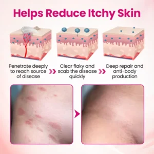 Natravor® IntiDefend Anti-HPV Interferon Gel