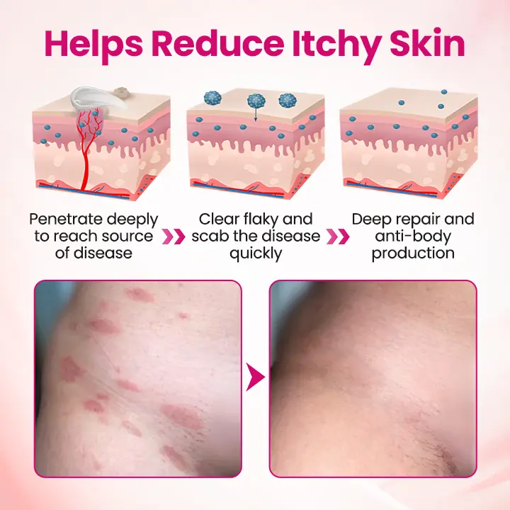 Natravor® IntiDefend Anti-HPV Interferon Gel