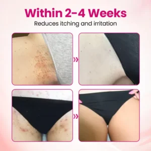 Natravor® IntiDefend Anti-HPV Interferon Gel