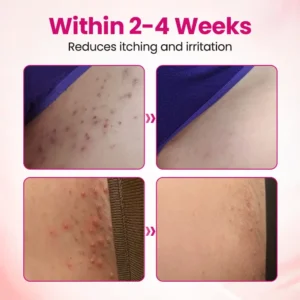 Natravor® IntiDefend Anti-HPV Interferon Gel