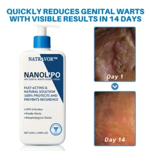 Natravor™ NanoLipo HPV Genital Warts Eraser Cream