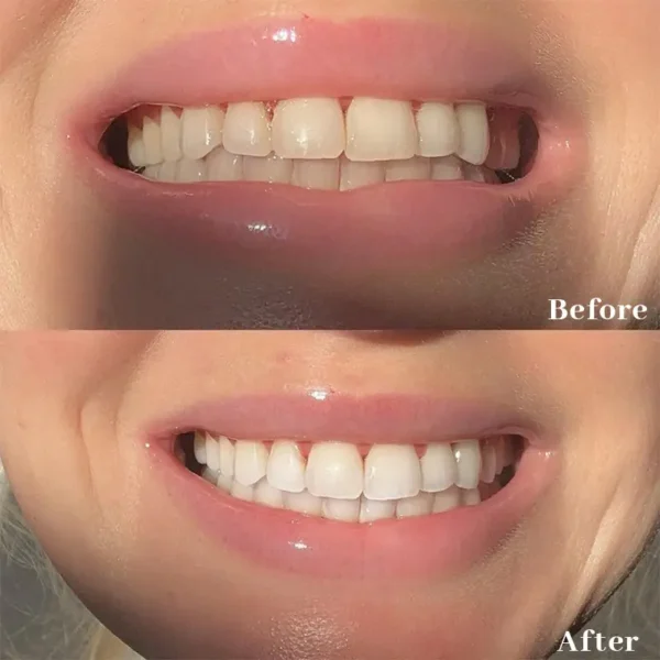 Natravor™ Teeth Whitening Strips, Non-peroxide, Fluoride Free & Vegan,  28 Strips (14-day Treatment)