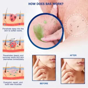 Official Store: Natravor™ NatureErase Instant Gel for Mole & Spot Removal