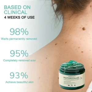 Official Store: Natravor™ NatureErase Instant Gel for Mole & Spot Removal
