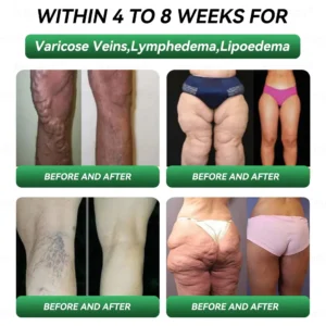 𝐎𝐟𝐟𝐢𝐜𝐢𝐚𝐥 𝐒𝐭𝐨𝐫𝐞|👩‍⚕️𝗟𝗲𝗿𝗰𝗲𝗮® 𝗚𝗟𝗣-𝟭 & 𝗠𝗮𝘁𝗿𝗶𝘅𝘆𝗹 3000 Health 7 in 1 Body Balance 𝐎𝐫𝐚𝐥 𝐒𝐨𝐥𝐮𝐭𝐢𝐨𝐧 For obesity, sagging skin, cardiovascular health, diabetes, sleep apnea, joint problems, etc.💕