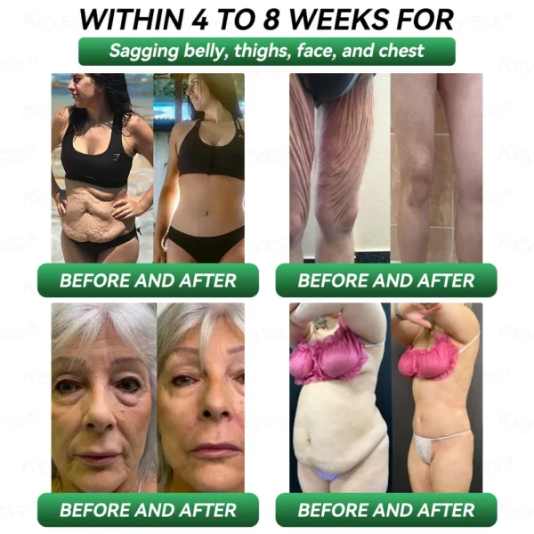 𝐎𝐟𝐟𝐢𝐜𝐢𝐚𝐥 𝐒𝐭𝐨𝐫𝐞|👩‍⚕️𝗟𝗲𝗿𝗰𝗲𝗮® 𝗚𝗟𝗣-𝟭 & 𝗠𝗮𝘁𝗿𝗶𝘅𝘆𝗹 3000 Health 7 in 1 Body Balance 𝐎𝐫𝐚𝐥 𝐒𝐨𝐥𝐮𝐭𝐢𝐨𝐧 For obesity, sagging skin, cardiovascular health, diabetes, sleep apnea, joint problems, etc.💕