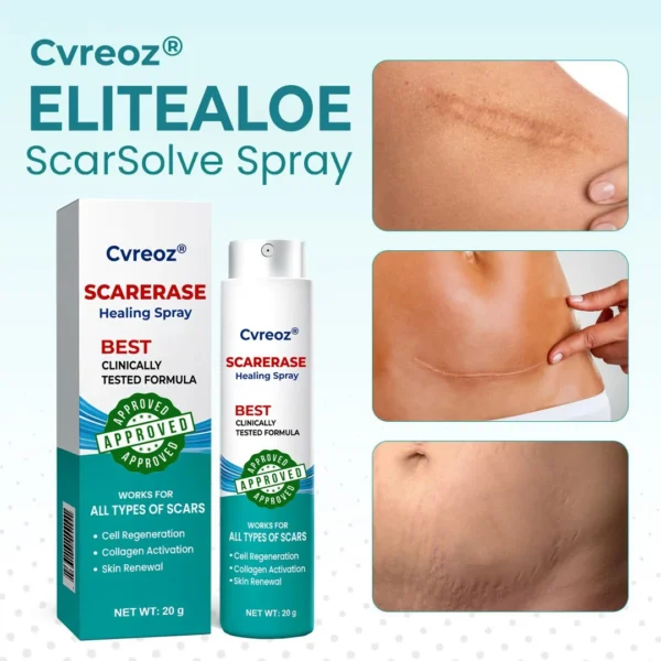 ⏰ Last Day Promotion 60% OFF 🔥 Cvreoz® EliteAloe ScarSolve Spray