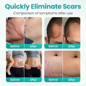 ⏰ Last Day Promotion 60% OFF 🔥 Cvreoz® EliteAloe ScarSolve Spray