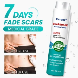 ⏰ Last Day Promotion 60% OFF 🔥 Cvreoz® EliteAloe ScarSolve Spray