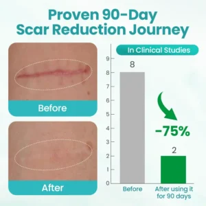 ⏰ Last Day Promotion 60% OFF 🔥 Cvreoz® EliteAloe ScarSolve Spray