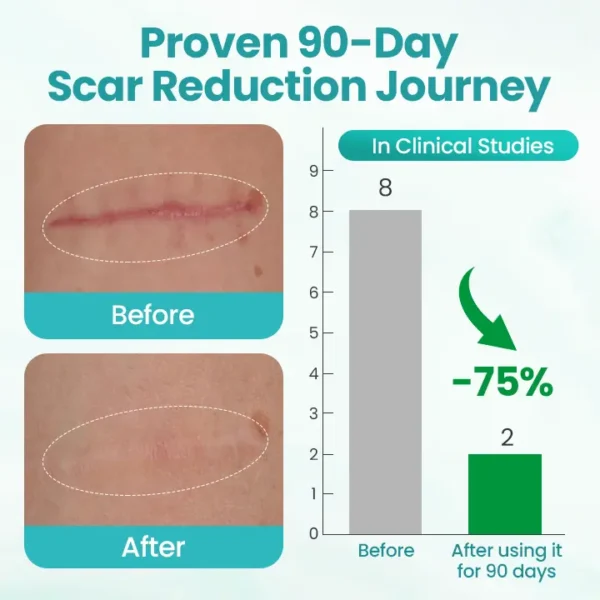 ⏰ Last Day Promotion 60% OFF 🔥 Cvreoz® EliteAloe ScarSolve Spray