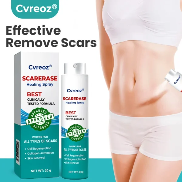 ⏰ Last Day Promotion 60% OFF 🔥 Cvreoz® EliteAloe ScarSolve Spray