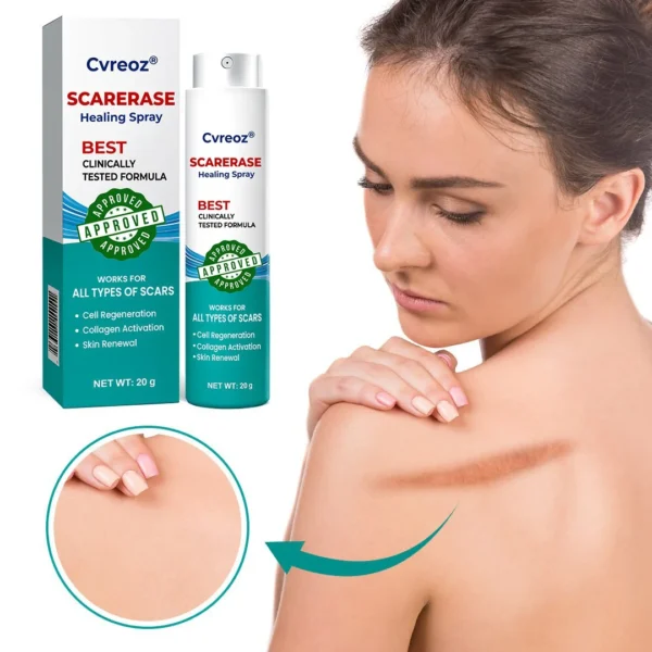 ⏰ Last Day Promotion 60% OFF 🔥 Cvreoz® EliteAloe ScarSolve Spray