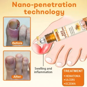 Cvreoz® Bee Venom Nail Roll-On