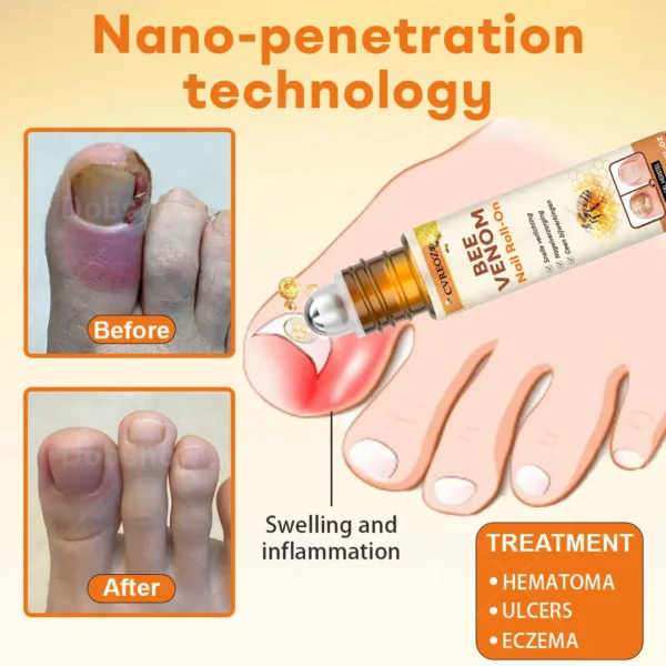 Cvreoz® Bee Venom Nail Roll-On