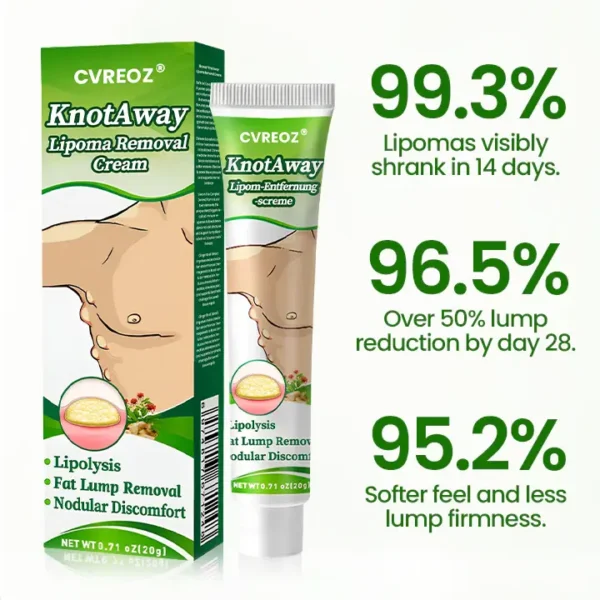 LIMITED TIME SALE OFF 70%🔥 Cvreoz® KnotAway Lipoma Removal Cream