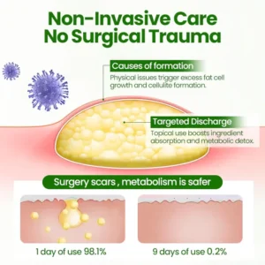LIMITED TIME SALE OFF 70%🔥 Cvreoz® KnotAway Lipoma Removal Cream