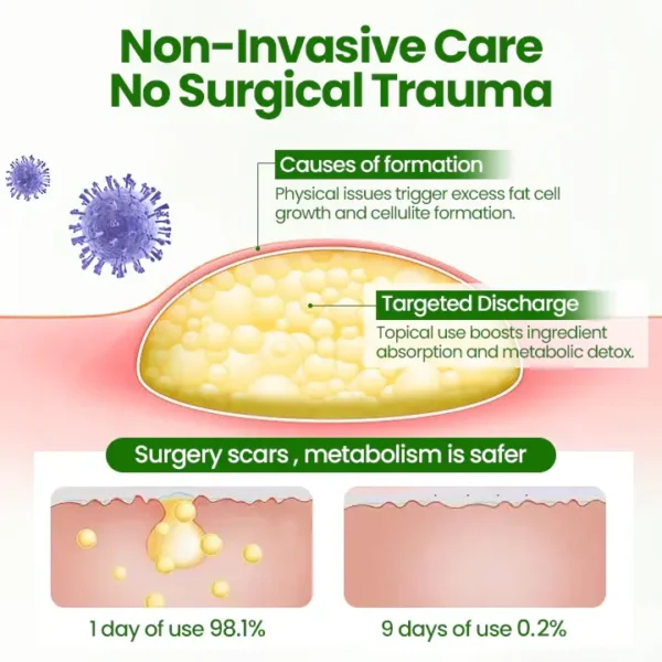 LIMITED TIME SALE OFF 70%🔥 Cvreoz® KnotAway Lipoma Removal Cream