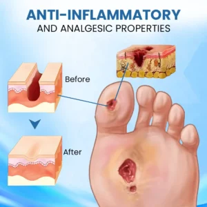 ⏰Last Day Promotion: 70% OFF 🔥Cvreoz® Diabetic Foot Healing Cream