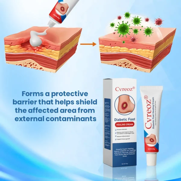 ⏰Last Day Promotion: 70% OFF 🔥Cvreoz® Diabetic Foot Healing Cream