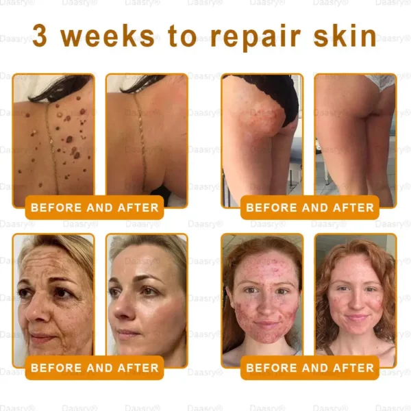 Mayo & Cleveland Clinic Store: Made IN USA - Natravor™"Dermal Gold" Botox Bee Venom Skin Restoration Cream - LAST DAY 80% OFF