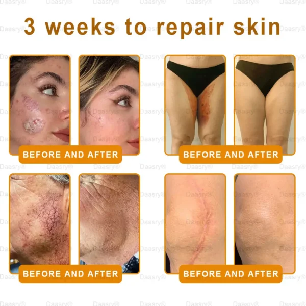 Mayo & Cleveland Clinic Store: Made IN USA - Natravor™"Dermal Gold" Botox Bee Venom Skin Restoration Cream - LAST DAY 80% OFF