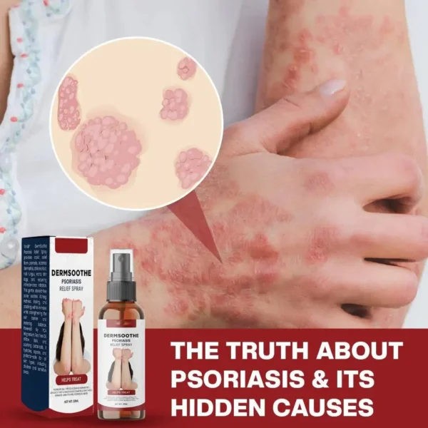 Natravor® DermSoothe Psoriasis Relief Spray