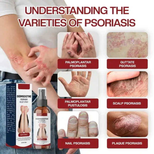 Natravor® DermSoothe Psoriasis Relief Spray