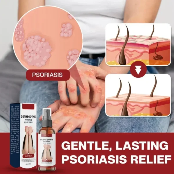 Natravor® DermSoothe Psoriasis Relief Spray