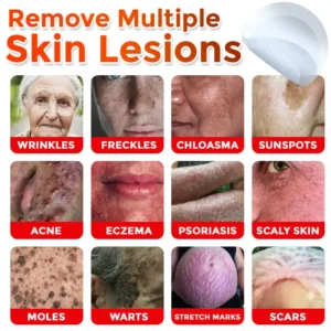Natravor® MicroNeedle Botanic Skin Tag Removal Patch ✅Australian Made