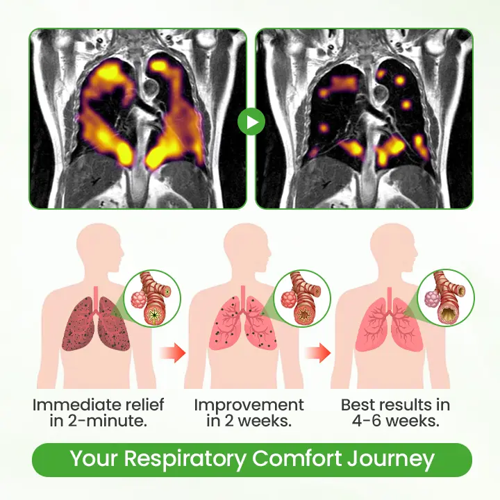 Cvreoz® HerbaAir Mullein Lung Purifier