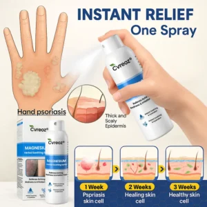 Cvreoz® Magnesium Herbal Psoriasis Spray ⚕️ FDA Certified