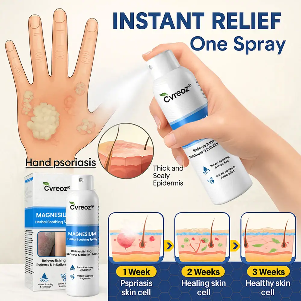 Cvreoz® Magnesium Herbal Psoriasis Spray ⚕️ FDA Certified