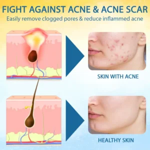 🎉HOT SALE: 60% OFF🔥 8M+ SOLD️🏆Cvreoz® PsoriasisCare Mellifera Venom Skin Healing Spray