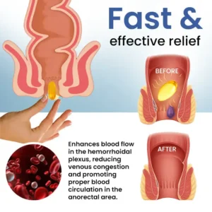 🔥LIMITED DEAL: 60% OFF🔥Cvreoz® Natural Hemorrhoid Capsules