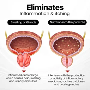 Last Day Discount: 87% OFF 🎇 NATRAVOR® ProstaAir Dual-Function Nasal Inhaler🌟
