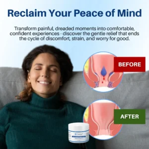 🏆Official Store|70% Off! Cvreoz® Hemorrhoid & Fissure Cream