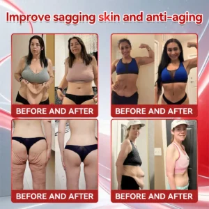 Official store|NATRAVORยฎ๐ฎ๐๐ฃ-๐ญ+๐ช๐๐๐๐๐๐๐ฃ ๐๐๐ฉ๐๐๐
๐๐ ๐พ๐๐๐ด๐ต๐ ๐๐จ๐ฌ๐ฌ & ๐ญ๐๐๐๐๐ฃ๐ ๐ถ๐๐๐ฅ ๐บ๐๐ฅ๐๐๐๐๐ ๐๐ ๐ผ๐ฏ๐ฒ๐๐ถ๐๐, ๐ณ๐ถ๐ฟ๐บ๐ ๐๐ธ๐ถ๐ป, ๐ฐ๐ฎ๐ฟ๐ฑ๐ถ๐ผ๐๐ฎ๐๐ฐ๐๐น๐ฎ๐ฟ ๐ฑ๐ถ๐๐ฒ๐ฎ๐๐ฒ,๐ฑ๐ถ๐ฎ๐ฏ๐ฒ๐๐ฒ๐,๐๐น๐ฒ๐ฒ๐ฝ ๐ฎ๐ฝ๐ป๐ฒ๐ฎ,๐ท๐ผ๐ถ๐ป๐ ๐ฝ๐ฟ๐ผ๐ฏ๐น๐ฒ๐บ๐,๐ฎ๐ป๐ฑ ๐บ๐ผ๐ฟ๐ฒ