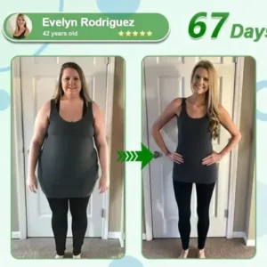 𝑳𝒆𝒓𝒄𝒆𝒂® 𝑵𝒂𝒏𝒐 𝑴𝒊𝒄𝒓𝒐𝒏𝒆𝒆𝒅𝒍𝒆 𝑷𝒂𝒕𝒄𝒉 𝒘𝒊𝒕𝒉 𝑺𝑴𝑮𝑻-𝑮𝑳𝑷-1 & 𝑴𝒂𝒕𝒓𝒊𝒙𝒚𝒍 3000