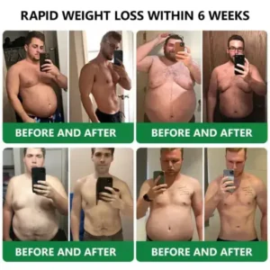 𝑳𝒆𝒓𝒄𝒆𝒂® 𝑵𝒂𝒏𝒐 𝑴𝒊𝒄𝒓𝒐𝒏𝒆𝒆𝒅𝒍𝒆 𝑷𝒂𝒕𝒄𝒉 𝒘𝒊𝒕𝒉 𝑺𝑴𝑮𝑻-𝑮𝑳𝑷-1 & 𝑴𝒂𝒕𝒓𝒊𝒙𝒚𝒍 3000