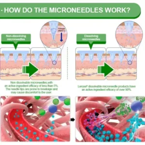 𝑳𝒆𝒓𝒄𝒆𝒂® 𝑵𝒂𝒏𝒐 𝑴𝒊𝒄𝒓𝒐𝒏𝒆𝒆𝒅𝒍𝒆 𝑷𝒂𝒕𝒄𝒉 𝒘𝒊𝒕𝒉 𝑺𝑴𝑮𝑻-𝑮𝑳𝑷-1 & 𝑴𝒂𝒕𝒓𝒊𝒙𝒚𝒍 3000