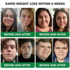 𝑳𝒆𝒓𝒄𝒆𝒂® 𝑵𝒂𝒏𝒐 𝑴𝒊𝒄𝒓𝒐𝒏𝒆𝒆𝒅𝒍𝒆 𝑷𝒂𝒕𝒄𝒉 𝒘𝒊𝒕𝒉 𝑺𝑴𝑮𝑻-𝑮𝑳𝑷-1 & 𝑴𝒂𝒕𝒓𝒊𝒙𝒚𝒍 3000